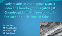 Early results of AMIC and Chondro-gide matrix procedure  in Osteochondral lesions of talus